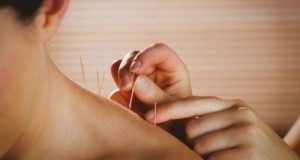 Os benefícios da acupuntura para a saúde feminina