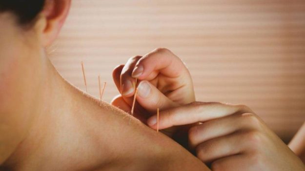 Os benefícios da acupuntura para a saúde feminina